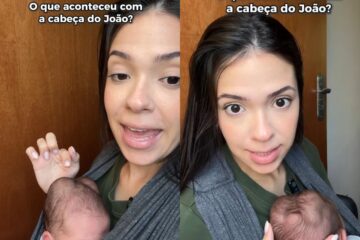 Influenciadora compartilha detalhes sobre os “calombos” na cabeça do filho e apresenta solução para o tratamento