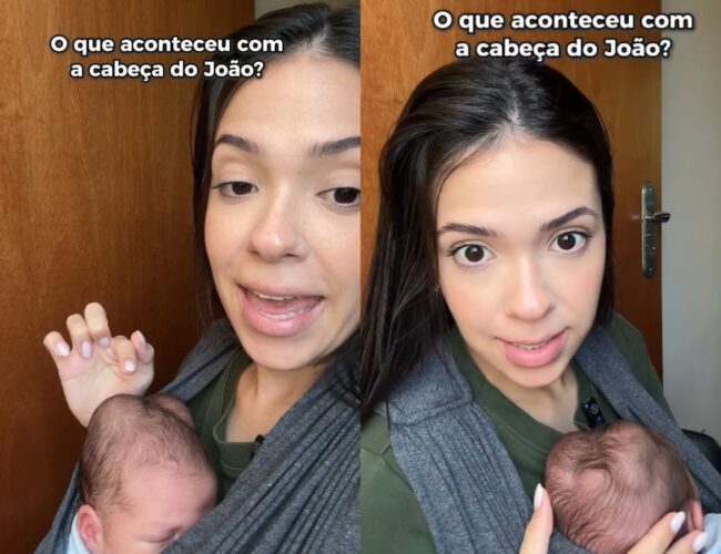 Influenciadora compartilha detalhes sobre os “calombos” na cabeça do filho e apresenta solução para o tratamento